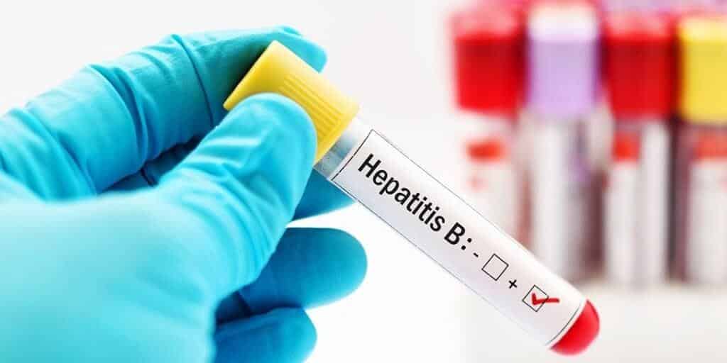 Asi Nedir Hepatit B